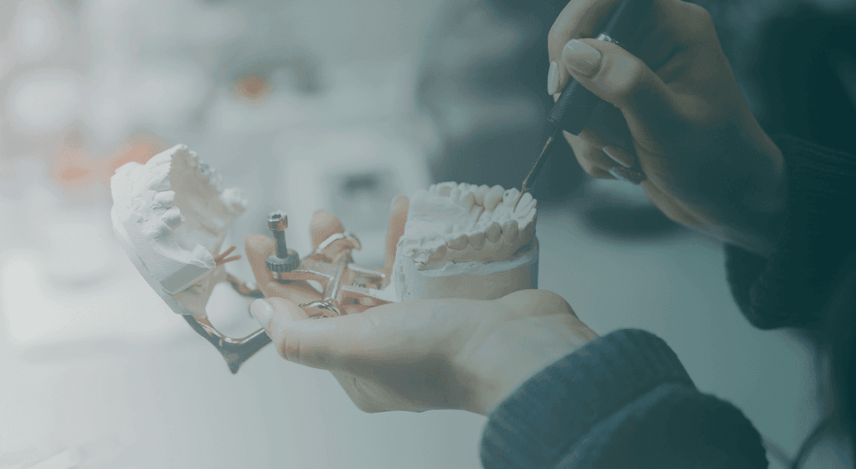 Установка имплантанта 85.000 р.