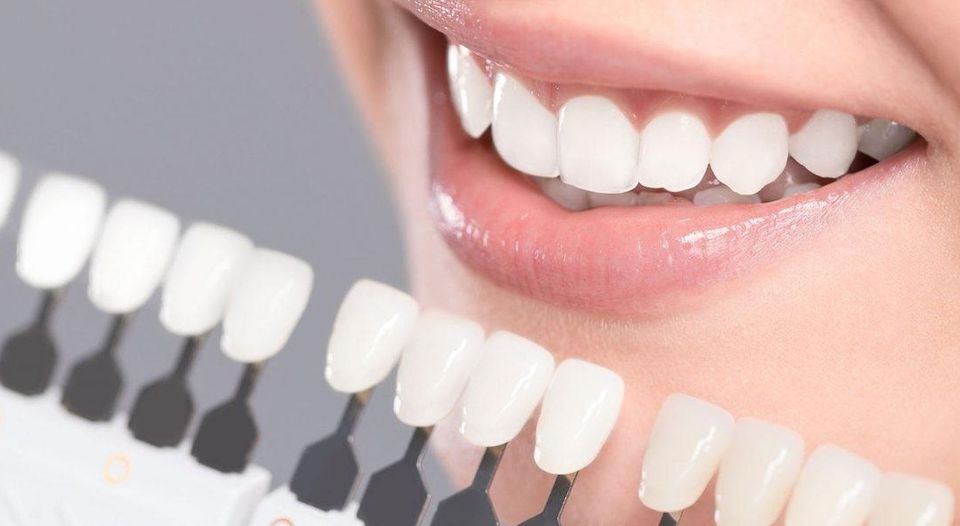 Отбеливание